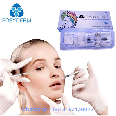 24 mg/ml Gesichtsfüller Fosyderm ha-Hautfüller-Hyaluronsäure-Gel-Einspritzungen