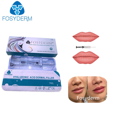 Kreuz 1ml verband Hyaluronsäure, die Hautfüller für Lippen Chin riechen