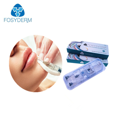Hyaluronsäure-Gel-Natriumfüller für Lippe injizierbares 1.1ml