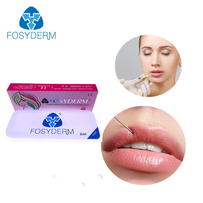 injizierbarer Hyaluronate ha Hautfüller 2ml nehmen Soem an