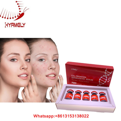 PDRN-Serum für Gesichts- Haut-Regenerations-Hyamely-Einspritzung Mesotherapy