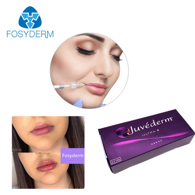 Hyaluronsäure-Hautfüller-Gel Juvederm-Lippenfüller 24mg/Ml Ultra3 Ultra4 Voluma