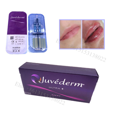 Juvederm Ultra4 Dermal Filler Lippenfiller Gesichtslifting Ha Gel Injektion