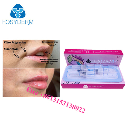 Hyaluronsäure Ha Injektionen 1 ml 2 ml 5 ml
